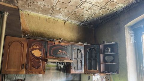 Mężczyzna z poważnymi poparzeniami