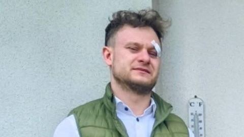 Policja poszukuje zaginionego 27-latka